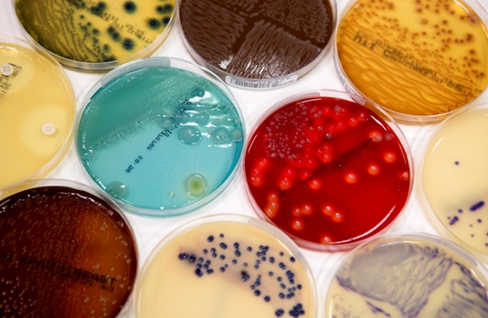 Wat doet een Deskundige Infectiepreventie?